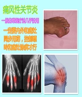 痛风性关节炎-注射中药治疗方法